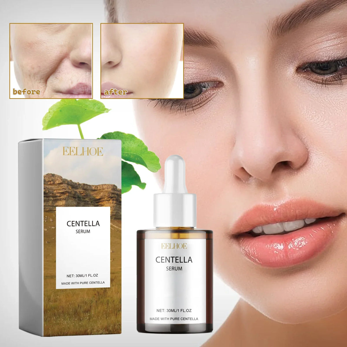 Centella Asiatica Skin Serum - Deep Moisturize &amp; Replenish Care Essence Improve Skin Health Relieve Dry &amp; Discomfort