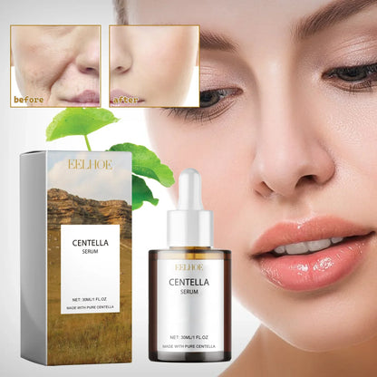 Centella Asiatica Skin Serum - Deep Moisturize &amp; Replenish Care Essence Improve Skin Health Relieve Dry &amp; Discomfort