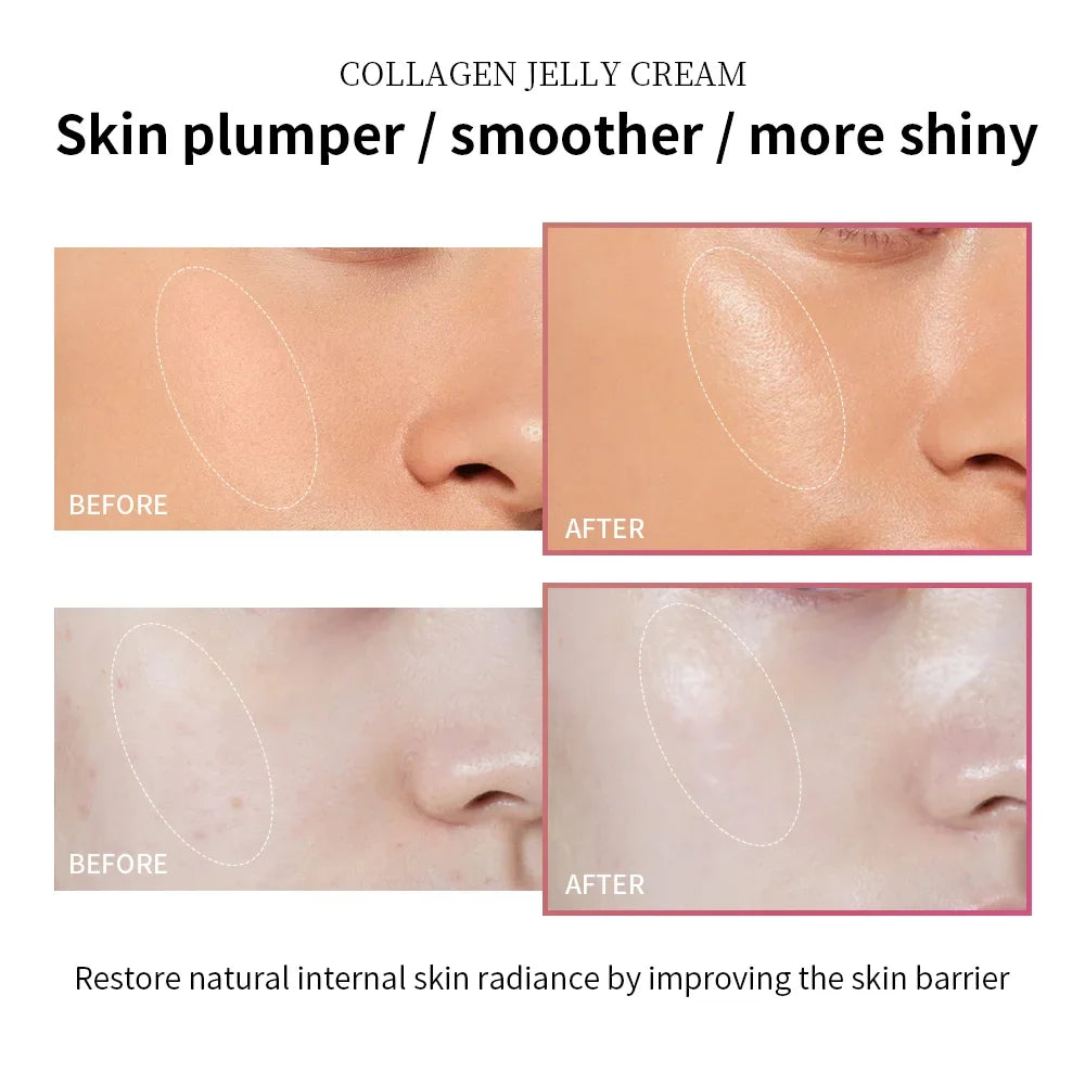 Moisturizing Collagen Jelly Cream Niacinamide Hydrolyzed Collagen Tightening Soothing Anti-Aging Firmness Hydration Skincare