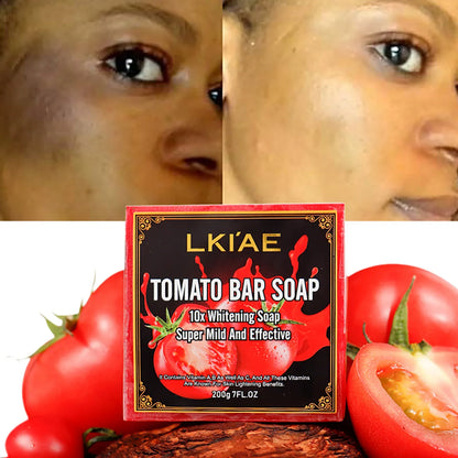 LKIAE Whitening Reduce Dark Spots &amp; Hyperpigmentation Facial Brightening Vitamin C Bar Soap For The Skin Care