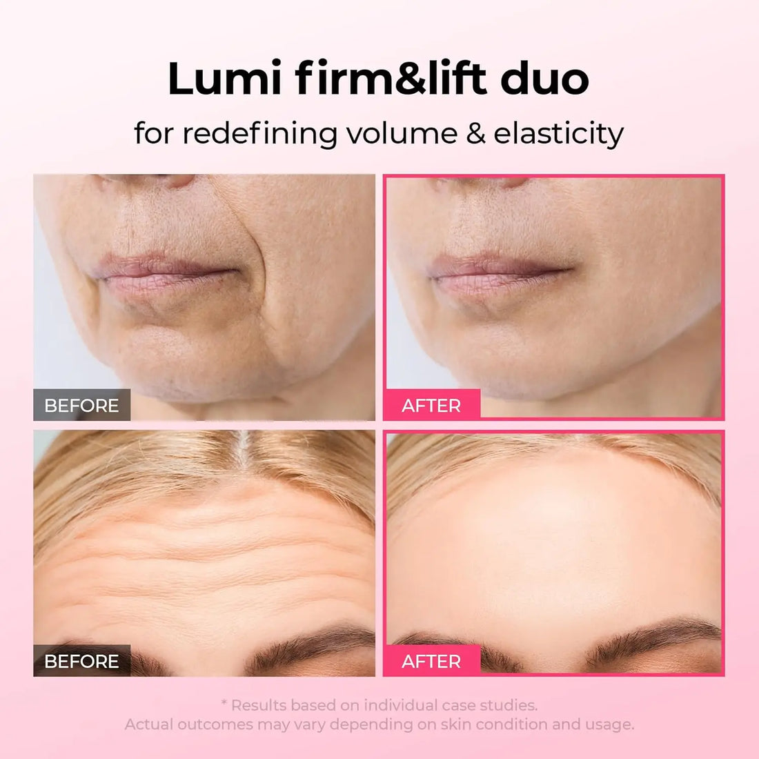 Dr.Melaxin Lumi firm &amp; lift Duo | Korean facial Collagen Firming serum plumping skin &amp; tightening refines skin repair density