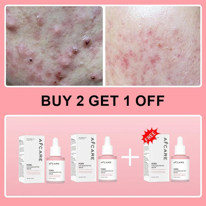 Collagen Peptide Facial Serum Targets Dull Skin Boosts Skin Elasticity Stimulates Skin Renewal Repair Salmon PDRN KOREAN Product