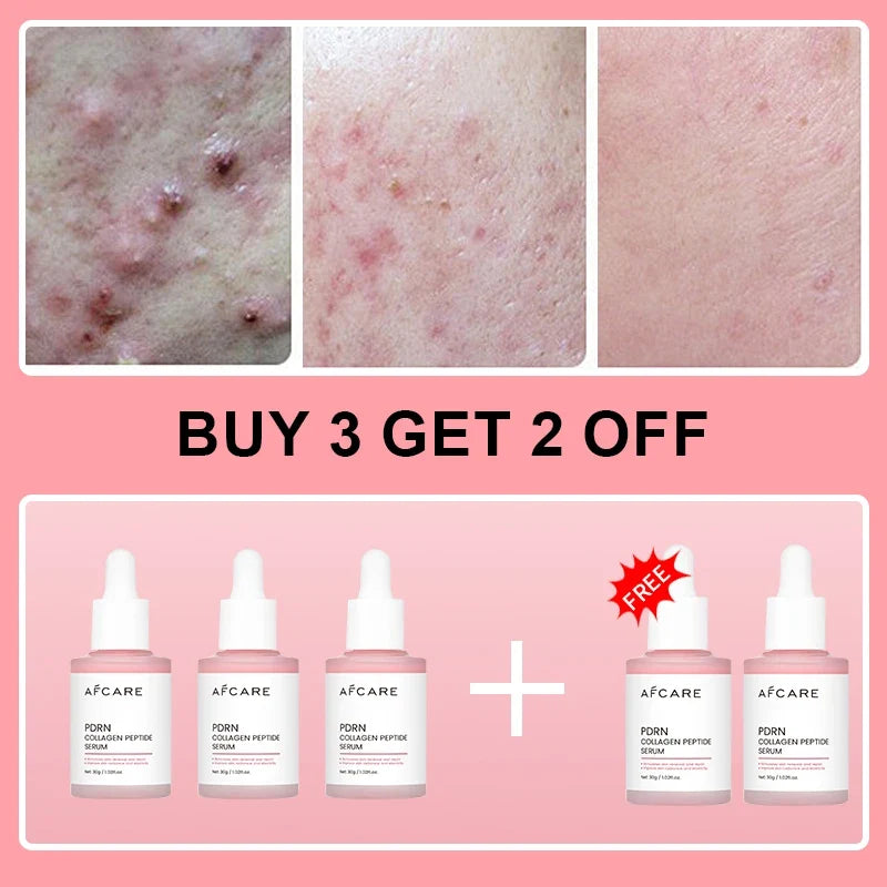 Collagen Peptide Facial Serum Targets Dull Skin Boosts Skin Elasticity Stimulates Skin Renewal Repair Salmon PDRN KOREAN Product