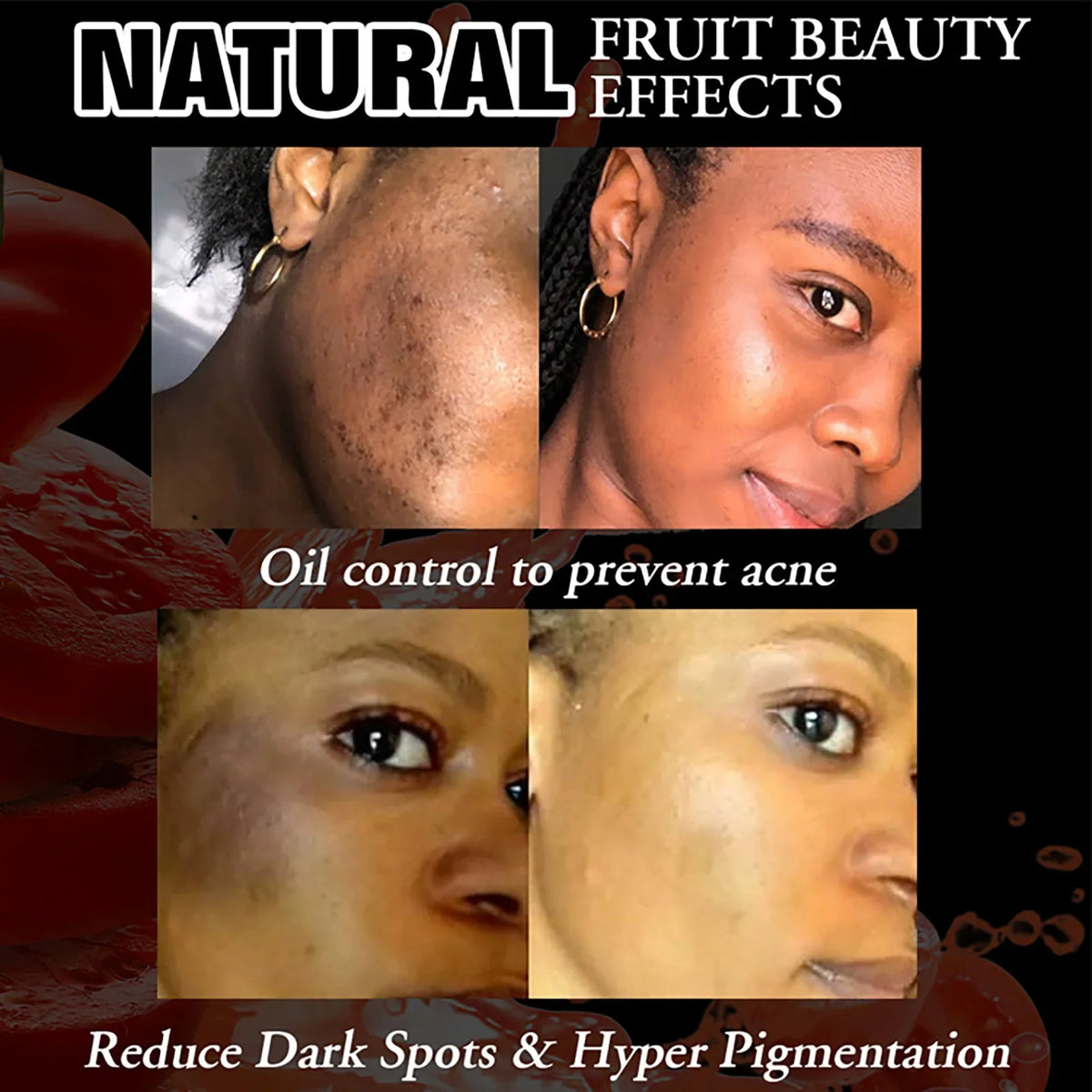 LKIAE Whitening Reduce Dark Spots &amp; Hyperpigmentation Facial Brightening Vitamin C Bar Soap For The Skin Care