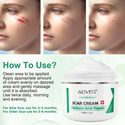 ALVER Acne Scar Stretch Marks Remover Cream Skin Repair Acne Black Dots Spots Acne Treatment Blackhead Bleaching Cream 50ml