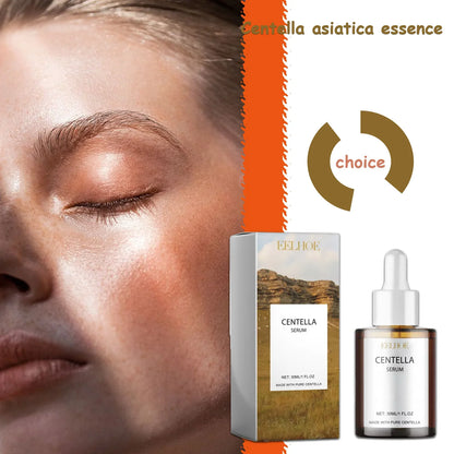 Centella Asiatica Skin Serum - Deep Moisturize &amp; Replenish Care Essence Improve Skin Health Relieve Dry &amp; Discomfort