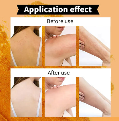 Natural Turmeric Scrub, For Face &amp; Body, Brightening, Reduce Acne, Clean And Smooth Skin, Deeply Exfoliates, 250g/8.8 oz